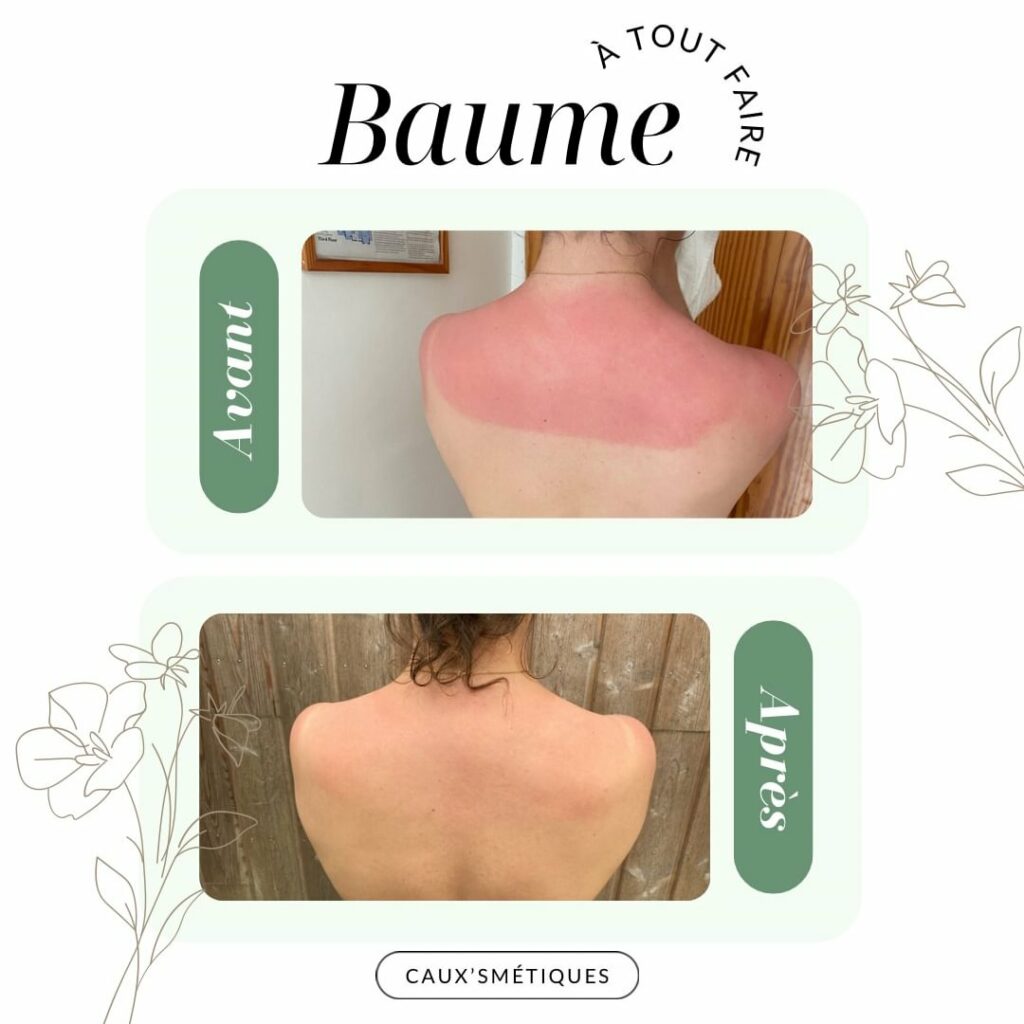 BAUME À TOUT FAIRE CAUXSMETIQUES DE NORMANDIE