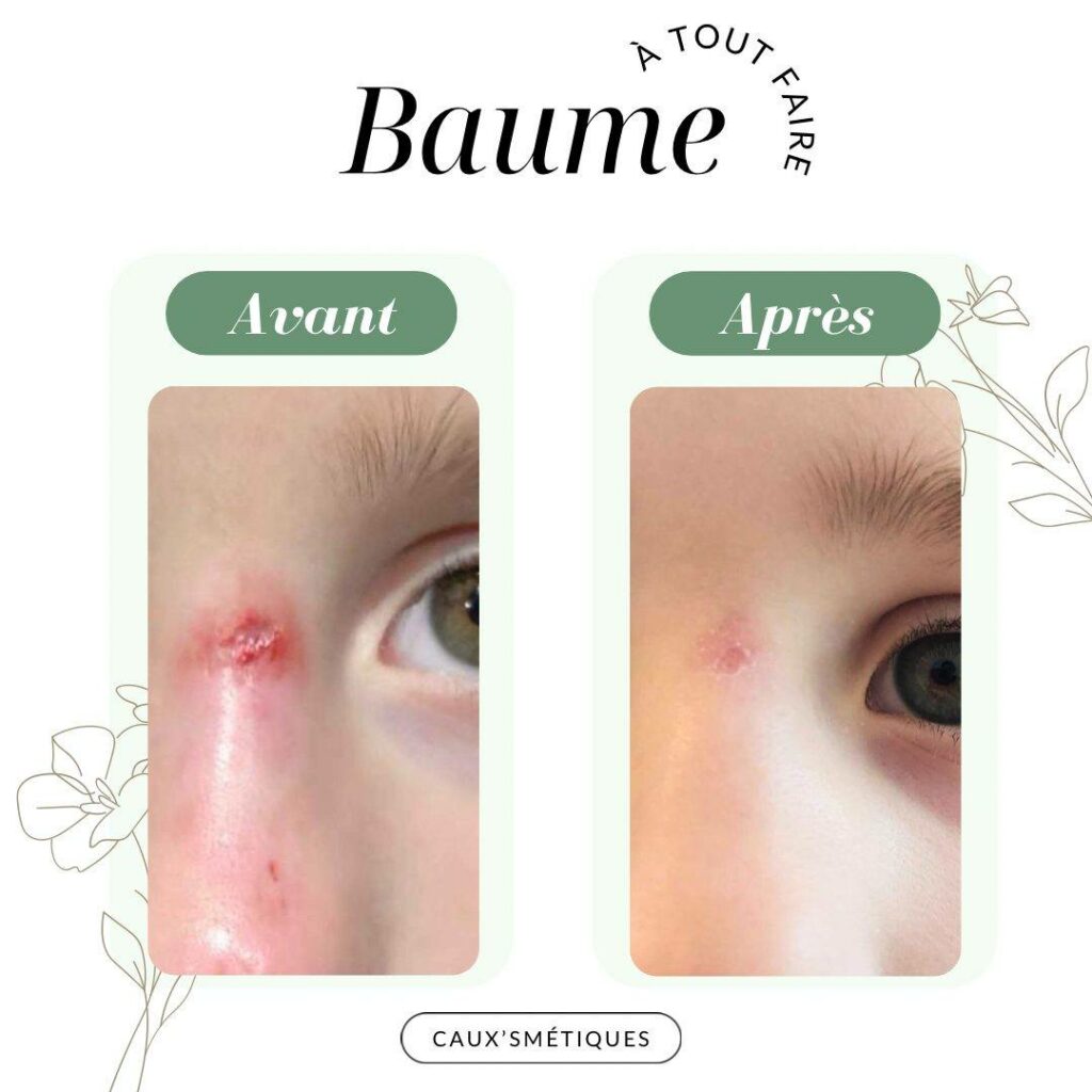 BAUME À TOUT FAIRE CAUXSMETIQUES DE NORMANDIE